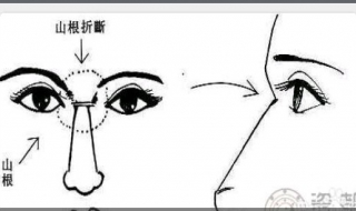 低鼻梁怎么办 低鼻梁怎么办小妙招