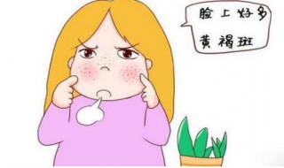 脸上黄褐斑怎么办 脸上黄褐斑怎么办,怎么才能去掉