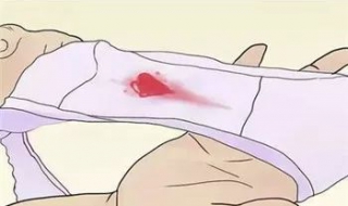 夫妻生活出血怎么办（夫妻生活出血怎么办,可吃什么药止血）