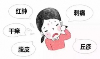 化妆品过敏怎么办（化妆品过敏怎么办脸部用什么药）