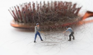 最近掉头发很厉害怎么办 最近掉头发很厉害怎么办女性