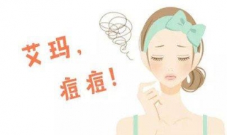 生青春痘怎么办（生青春痘用什么药最好）