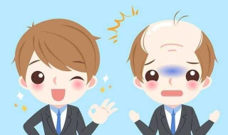 年轻人脱发怎么办（年轻人脱发怎么办?）