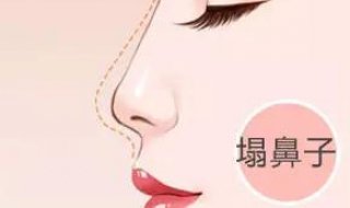 塌鼻梁怎么办 鼻子大塌鼻梁怎么办