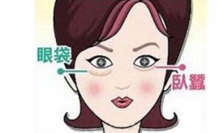 眼袋太大怎么办（眼袋太大怎么办能改善吗）