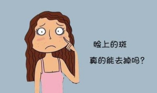 怎样去斑最有效 怎样去斑最有效去斑