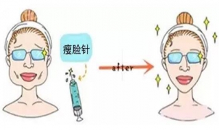 瘦脸针后的注意事项 打完瘦脸针后的注意事项