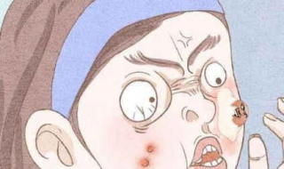 有效去痘印（有效去痘印产品排名）
