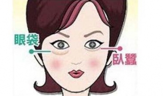 眼袋重怎么办（小孩子眼袋重怎么办）