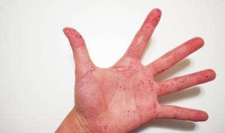 手被辣椒辣了怎么办（手被辣椒辣了怎么办?最快解决辣椒辣手方法）