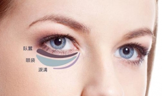 有眼袋该怎么办 有眼袋该怎么办才能去除