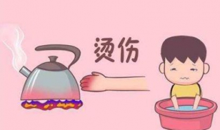皮肤烫伤怎么办 儿童皮肤烫伤怎么办