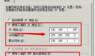 怎么设置本地连接ip（怎么设置本地连接2）