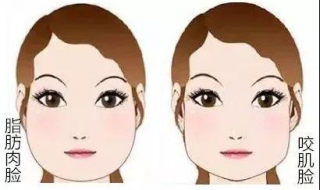 咬肌发达怎么办 一边咬肌大一边咬肌小怎么改善