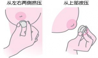19岁女生乳头内陷怎么办
