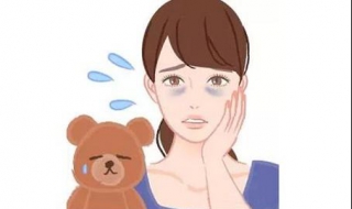 下眼袋松弛怎么办 下眼袋松弛怎么办恢复