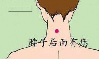 苦情痣是什么意思 苦情痣是什么意思呢女