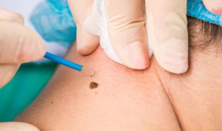 男孩哪里长痣最好（男人10处有痣是富贵痣）