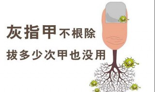 治灰指甲的绝招 治灰指甲妙招