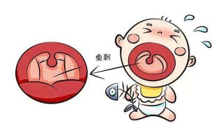 成人鱼刺卡喉轻松解决（成人被鱼刺卡住有什么好办法）