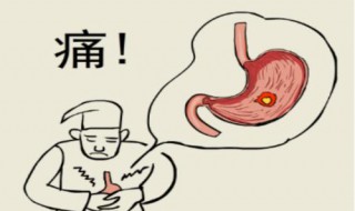 胃糜烂的克星（胃糜烂克星两味药）