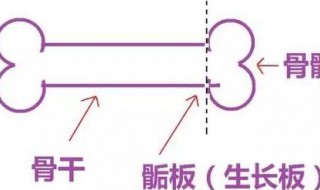 骨骺线闭合的3大标志 骨骺线闭合长什么样