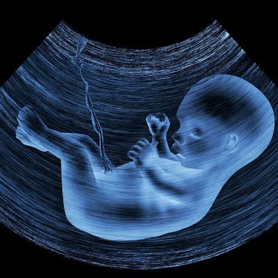 生化妊娠是什么意思 生化妊娠流产是怎么造成的