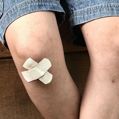 腿上有鸡皮疙瘩怎么办（女生腿上有鸡皮疙瘩怎么办）