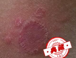 大腿内侧痒是什么病啊（大腿内侧痒是什么毛病）