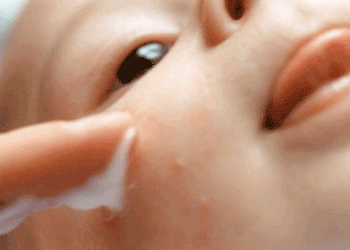 你知道皮肤过敏的症状有哪些吗 皮肤过敏都有哪些症状